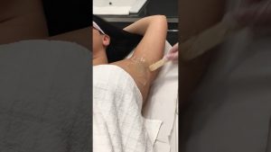 Laser diodo - Depilacio definitva - La Pobla del Segur - Centre Estetic Alba